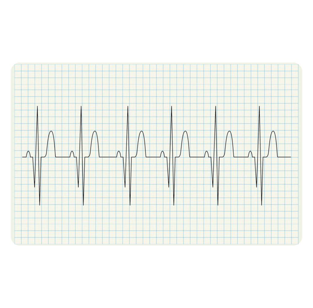 ECG Management